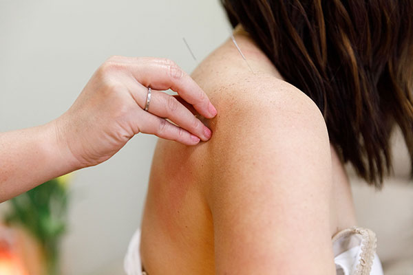 Pain and Acupuncture